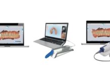 Use Cases for Intraoral Scanners